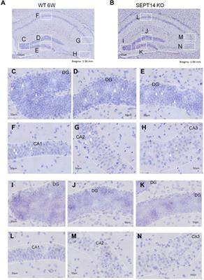 Effects of Septin-14 Gene Deletion on Adult Cognitive/Emotional Behavior